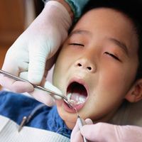 So klappt der erste Zahnarztbesuch