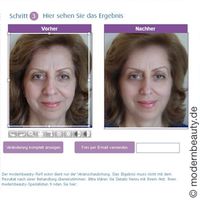 Schönheits-OP: modernbeauty-Reflector zeigt, wie Sie nach einer Nasen-OP oder Brust-OP aussehen