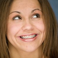 Zahnspange für Erwachsene: Immer mehr Deutsche lassen sich die Zähne richten