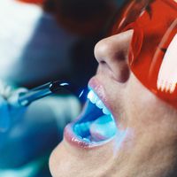 Hellere Zähne: UV-Bleaching ist gefährlich und bietet keine Vorteile